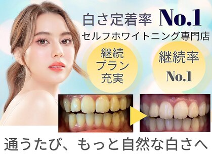 LBSホワイトニング 渋谷店の写真