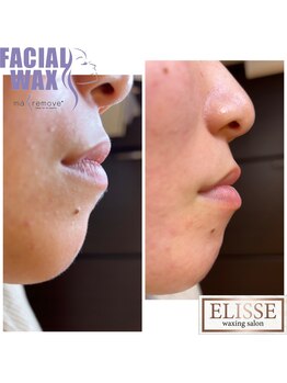 エリス(ELISSE)/フェイシャルワックス