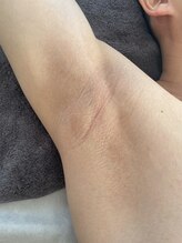 テンピスモ(tempismo)/before after