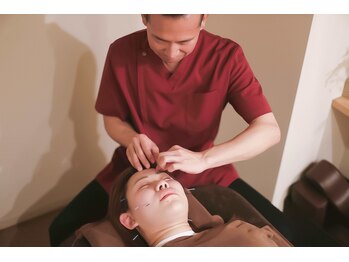 ウォーミー 鍼灸サロン(warmy)/美容鍼は男性でもOK!