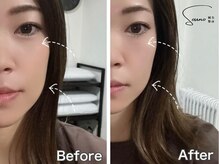 ソウノ 御茶ノ水(Souno)/お客様ビフォー・アフター