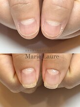 マリーロール 淀屋橋本店(Marie Laure)/自爪育成/深爪矯正/ネイルケア