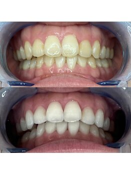 プロテア 藤枝店(PROTEA)/医療提携ホワイトニング