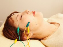 カエデ(Kaede)の雰囲気（初めての美容鍼は当院にお任せください☆15年3万人の実績★）