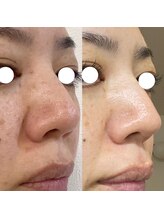 リラクゼーションの森/