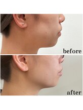 キビック(KIBIK)/【レモンボトル】