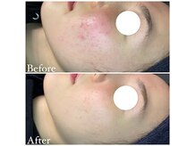 マドモアゼル 麻布十番の雰囲気（ハーブピーリング★麻布十番/肌管理）