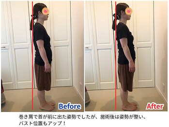 ラシュシュ/ビフォーアフター