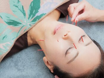 エスピーエー 桂坂(S.P.A)の写真/【国家資格者の確信】細胞から立て直すオーダーメイド美容鍼。東洋学に基づく、一生モノの素肌美を。

