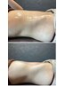 平日限定【12時~17時】分解・温め・ほぐし/くびれ・ヒップUP・美脚★7800円