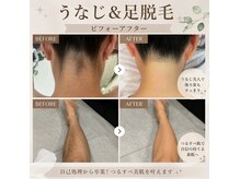 ボーテ デ ベル(Beaute de belle)の雰囲気(結果重視の脱毛で面倒な自己処理から卒業♪脱毛デビューもお任せ)