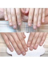 アモールネイル(amor nail)/お爪のコンプレックス解消