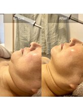 オンリーユータイム(ONLY YOU TIME)/新フェイシャルメニュー