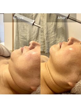 オンリーユータイム(ONLY YOU TIME)/新フェイシャルメニュー