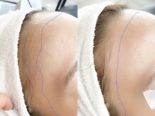 ネリネ 博多(nerine)/【全顔ワックス】