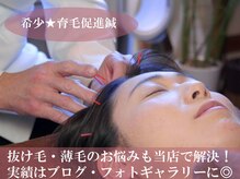 鍼灸整骨院 レメディの雰囲気（≪エリア希少≫育毛促進鍼でお悩みを根本解決♪）
