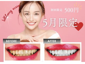 エクシアホワイトニング 江坂店