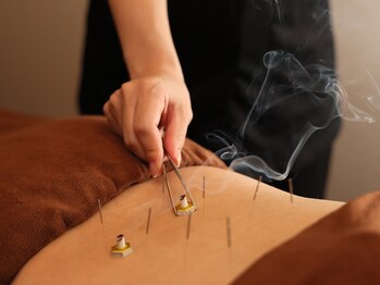 ハリラックス(HA:Ri/LAX)/【身体鍼灸の様子】