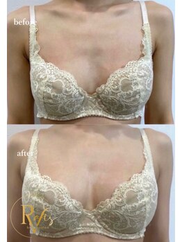 ラヴィス(ravis)/痩せ型でも胸が育つ!