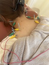 鍼灸サロン ヒマワリ(himawari)/肩電気鍼