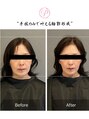 プライミー(PRIMY)&nbsp;左右差、輪郭改善