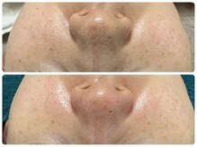 グラン ジュテ/お肌が変わる！PDRN美容液を輸入