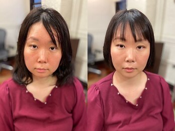 アトリエ スタンズ(atelierSTAENS)/30代の方ビフォー＆アフター