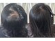 タカイ(TAKAI)の写真/【女性の生え際・頭頂部・抜け毛予防】頭皮の悩みに特化した本格レディーズ育毛促進★完全個室で安心ケア！