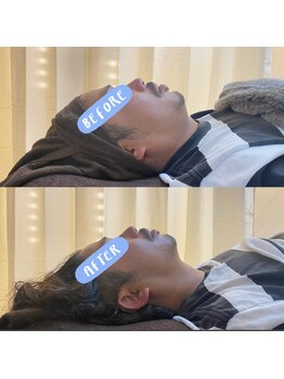 レコルト デ ベルシア BELCIA福岡店(recolte de BELCIA)/メンズかなりスッキリします!