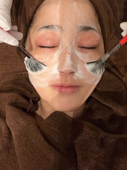 ブルーローズ(Blue.Rose)の写真/美容大国韓国で注目の肌管理メニュー☆次世代ピーリング『ララピール』導入!!ツルツル＆透明感のある肌へ♪