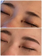 パルフェット(parfaite)/ハリウッドブロウリフト