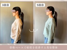 ほぐし屋 かすがい/3、5回目/猫背巻き肩矯正