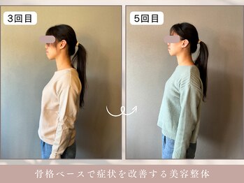 ほぐし屋 かすがい/3、5回目/猫背巻き肩矯正