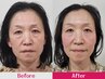 ≪40代・50代必見☆若魅力UP≫ 美容頭蓋小顔矯正