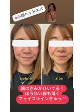 カイロプラティックアンズ(chiropractic&‘s)/98％が寝落ち！魔法のヘッドスパ