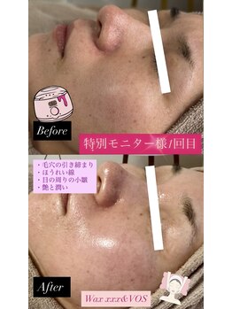 パタティパタタ(PatatiPatata)/wax脱毛でスキンケア