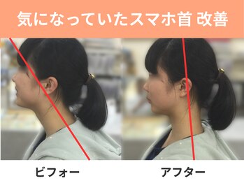 鍼灸整骨院やわら/気になっていたスマホ首改善