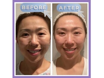 整体院 ツイてる(椎照)の写真/「呼吸を整え自然にリフトアップ」
顔のたるみは姿勢から変わります。