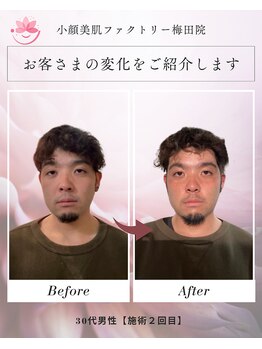 小顔美肌ファクトリー 梅田院/