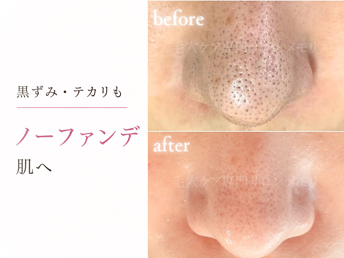 メモリ｜ホットペッパービューティー