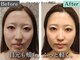 グレースフィオーレ 南越谷店(gracefiore)の写真/むくみ・たるみ・左右差・エラ・ゆがみ。頭蓋骨からアプローチすることで叶える丁寧な【小顔根本ケア】