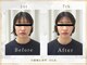 シルク(SILK)の写真/★顔の悩みに専門の小顔サロン★小顔だけでなく「エラ張り」「たるみ」「左右差」など顔の悩み改善まで◎