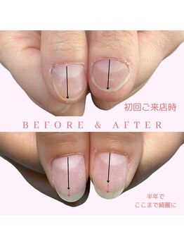 深爪育成メニュー