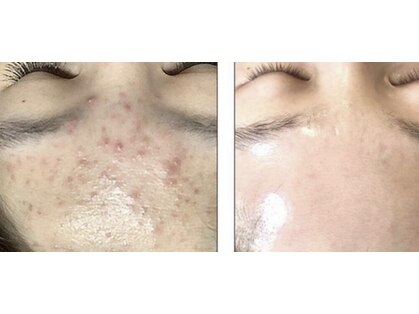 レクレアの写真