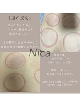 ニカ(Nica)/【虚の反応】