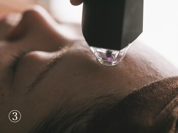 オレアグリーン 岡崎(OLEA green)/3、プラズマ照射(毛穴岡崎/小顔)