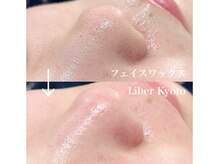 リベルキョウト 京都駅前店(Liber Kyoto)/フェイスワックス脱毛