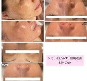 リリーココ(Lily Coco)