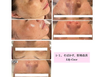 リリーココ(Lily Coco)の写真