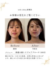 ウィズリリナ 新横浜(with Lilina.) 人気No.1 コース7回